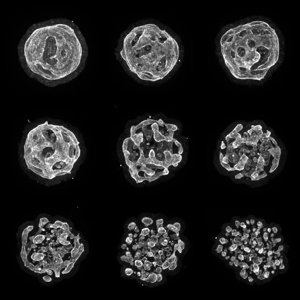 Neuroepithelial organoid morphology, 3D confocal imaging