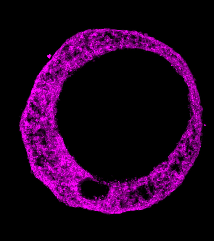 Cardiac organoid fluorescence microscopy