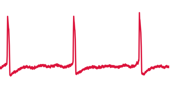 Optical mapping of cardiac electrophysiology